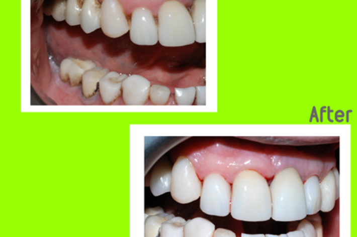 blog - Hello dental
