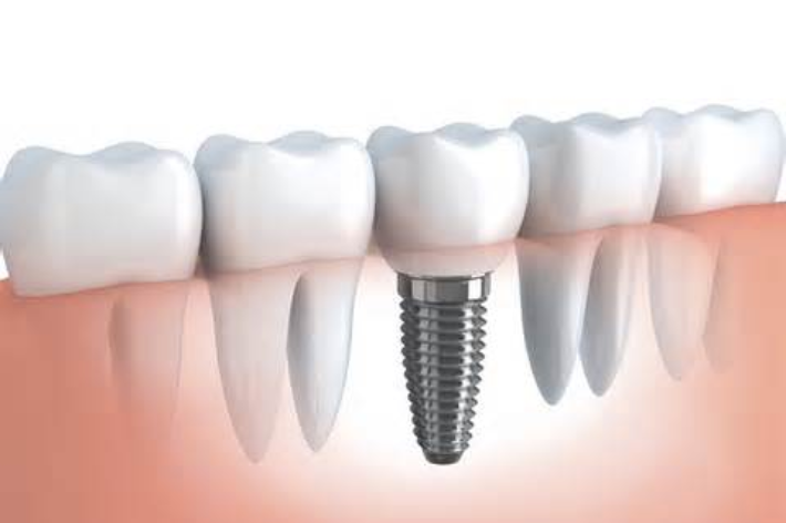 blog - Hello Dental