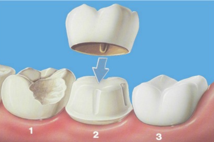 blog - Hello dental