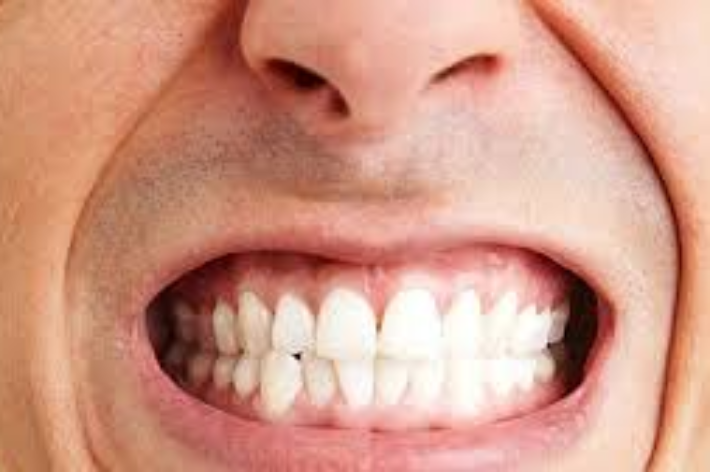 blog - Hello dental