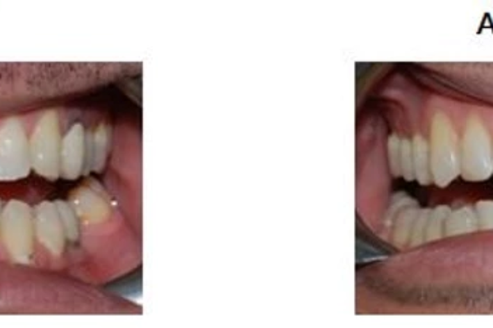 blog - Hello dental