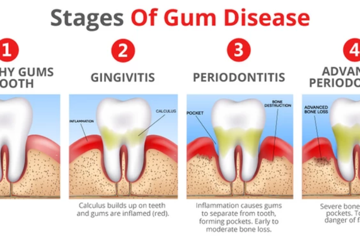 blog - Hello dental
