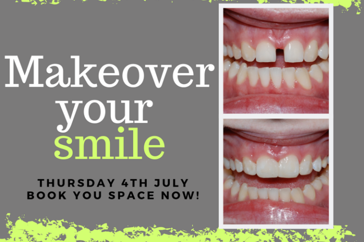 blog - Hello dental