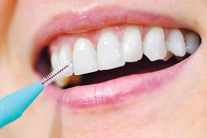 blog - Hello dental