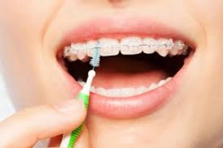 blog - Hello dental