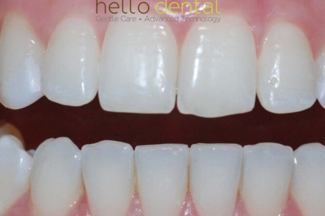 After - Hello Dental