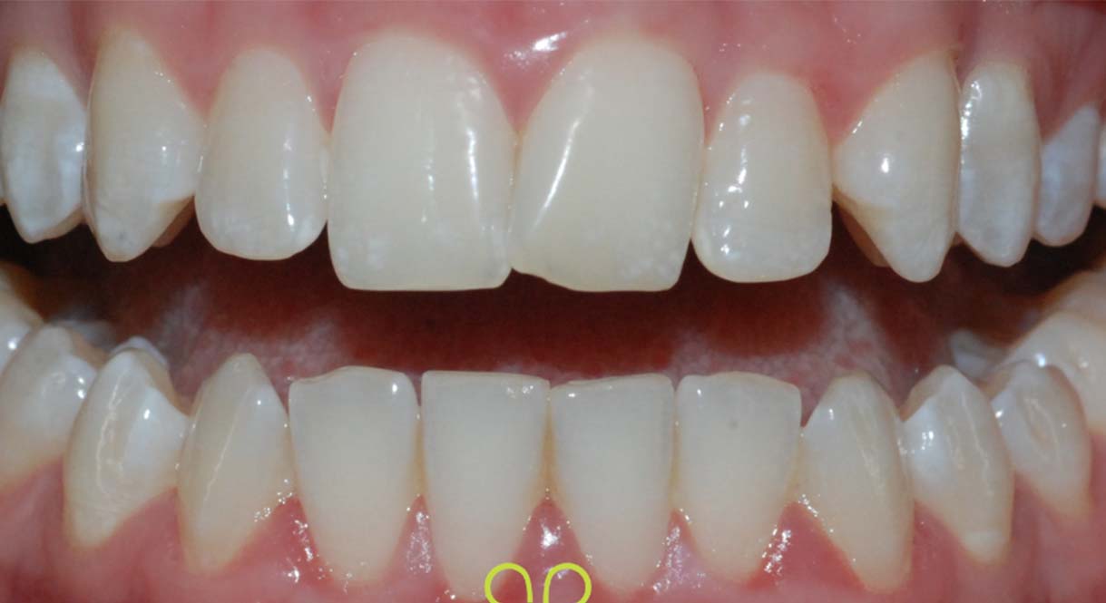 Before - Hello Dental