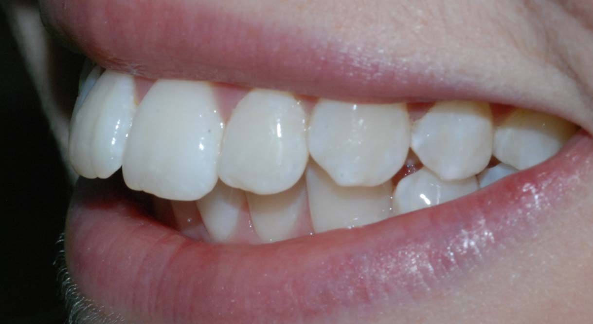 Before - Hello Dental