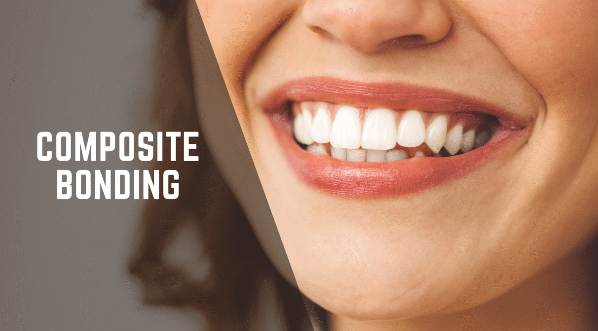 blog inner thumb : Hello dental